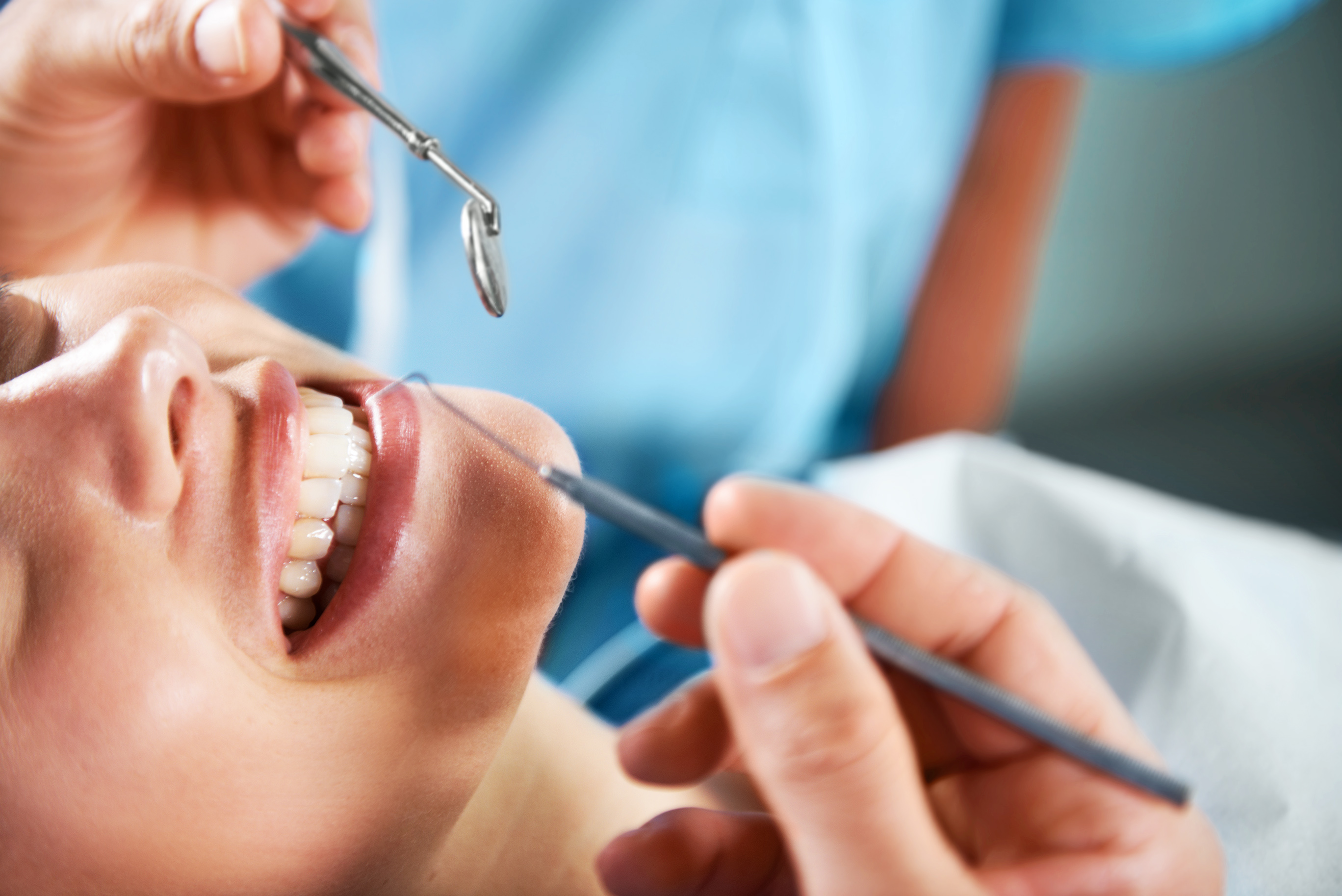 Deep Dental Cleanings Santa Barbara CA