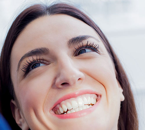 Tooth Bonding Santa Barbara