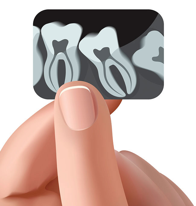 Dental X-rays Santa Barbara CA