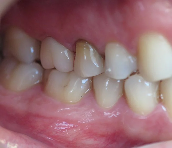 emergency dentist Santa Barbara After